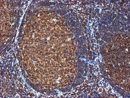 GATM / AGAT Antibody - IHC of paraffin-embedded Human tonsil using anti-GATM mouse monoclonal antibody. (Heat-induced epitope retrieval by 10mM citric buffer, pH6.0, 100C for 10min).