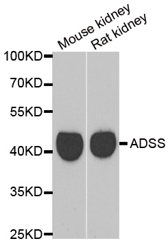 GATM / AGAT Antibody - Western blot analysis of extracts of various cell lines.