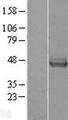 GATM / AGAT Protein - Western validation with an anti-DDK antibody * L: Control HEK293 lysate R: Over-expression lysate