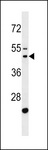 GATSL2 Antibody - GATSL1 Antibody western blot of MDA-MB231 cell line lysates (35 ug/lane). The GATSL1 antibody detected the GATSL1 protein (arrow).