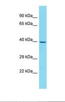 GATSL3 Antibody - Western blot of HepG2. GATSL3 antibody dilution 1.0 ug/ml.  This image was taken for the unconjugated form of this product. Other forms have not been tested.