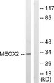 GAX / MEOX2 Antibody - Western blot analysis of lysates from COLO205 cells, using MEOX2 Antibody. The lane on the right is blocked with the synthesized peptide.