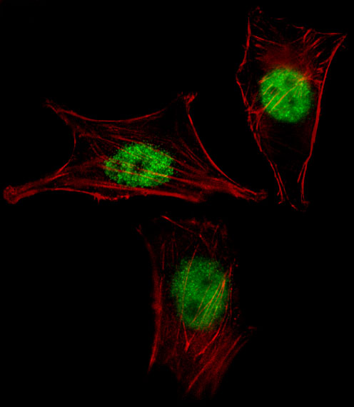 GAX / MEOX2 Antibody - Fluorescent image of NIH-3T3 cell stained with MEOX2 Antibody. NIH-3T3 cells were fixed with 4% PFA (20 min), permeabilized with Triton X-100 (0.1%, 10 min), then incubated with MEOX2 primary antibody (1:25, 1 h at 37°C). For secondary antibody, Alexa Fluor 488 conjugated donkey anti-rabbit antibody (green) was used (1:400, 50 min at 37°C). Cytoplasmic actin was counterstained with Alexa Fluor 555 (red) conjugated Phalloidin (7units/ml, 1 h at 37°C). MEOX2 immunoreactivity is localized to Nucleus significantly.