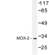 GAX / MEOX2 Antibody - Western blot of MOX-2 (N184) pAb in extracts from COLO205 cells.