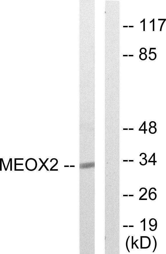 GAX / MEOX2 Antibody - Western blot analysis of extracts from COLO205 cells, using MEOX2 antibody.