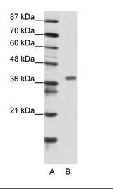 GAX / MEOX2 Antibody - A: Marker, B: Transfected 293T Cell Lysate.  This image was taken for the unconjugated form of this product. Other forms have not been tested.