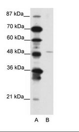 GAX / MEOX2 Antibody - A: Marker, B: Jurkat Cell Lysate.  This image was taken for the unconjugated form of this product. Other forms have not been tested.
