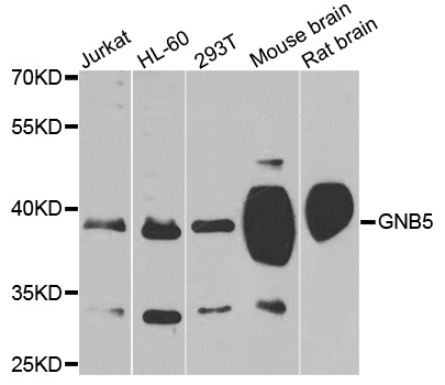 GB5 / GNB5 Antibody - Western blot analysis of extracts of various cells.