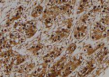 GB5 / GNB5 Antibody - 1:100 staining human kidney tissue by IHC-P. The sample was formaldehyde fixed and a heat mediated antigen retrieval step in citrate buffer was performed. The sample was then blocked and incubated with the antibody for 1.5 hours at 22°C. An HRP conjugated goat anti-rabbit antibody was used as the secondary.