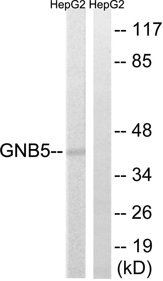 GB5 / GNB5 Antibody - Western blot analysis of extracts from HepG2 cells, using GNB5 antibody.