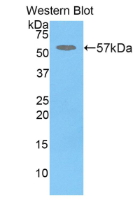 GBA / Glucosidase Beta Acid Antibody - Western blot of recombinant GBA / Glucosidase Beta Acid.  This image was taken for the unconjugated form of this product. Other forms have not been tested.