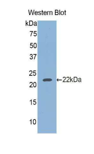 GBA / Glucosidase Beta Acid Antibody - Western blot of recombinant GBA / Glucosidase Beta Acid.  This image was taken for the unconjugated form of this product. Other forms have not been tested.