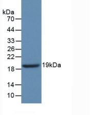 GBA / Glucosidase Beta Acid Antibody - Western Blot; Sample: Recombinant GbA, Human.