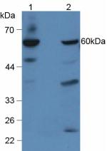 GBA / Glucosidase Beta Acid Antibody - Western Blot; Sample: Lane1: Human Hepg2 Cells; Lane2: Mouse Liver Tissue.