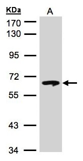 GBA / Glucosidase Beta Acid Antibody - Sample (30 ug of whole cell lysate). A: Hep G2. 7.5% SDS PAGE. GBA antibody diluted at 1:500