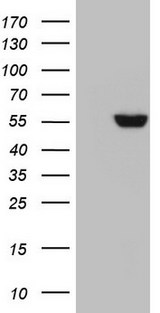 GBA / Glucosidase Beta Acid Antibody - HEK293T cells were transfected with the pCMV6-ENTRY control (Left lane) or pCMV6-ENTRY GBA (Right lane) cDNA for 48 hrs and lysed. Equivalent amounts of cell lysates (5 ug per lane) were separated by SDS-PAGE and immunoblotted with anti-GBA.