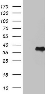 GBA / Glucosidase Beta Acid Antibody - E.coli lysate (left lane) and E.coli lysate expressing human recombinant protein fragment corresponding to amino acids 40-315 of human GBA (NP_000148) were separated by SDS-PAGE and immunoblotted with anti-GBA.