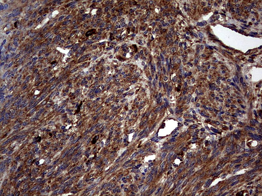 GBA / Glucosidase Beta Acid Antibody - IHC of paraffin-embedded Human endometrium tissue using anti-GBA mouse monoclonal antibody. (Heat-induced epitope retrieval by 1 mM EDTA in 10mM Tris, pH8.5, 120°C for 3min).