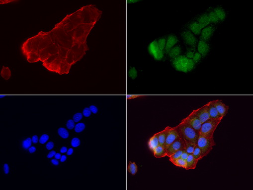 GBA / Glucosidase Beta Acid Antibody - Immunofluorescent staining of MCF-7 cells using anti-GBA mouse monoclonal antibody  green, 1:50). Actin filaments were labeled with Alexa Fluor® 594 Phalloidin. (red), and nuclear with DAPI. (blue).