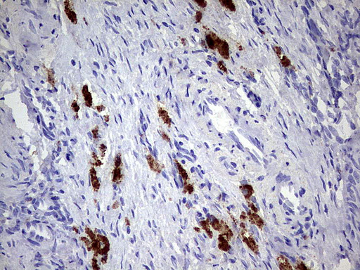 GBA / Glucosidase Beta Acid Antibody - Immunohistochemical staining of paraffin-embedded Human Ovary tissue using anti-GBA mouse monoclonal antibody.  heat-induced epitope retrieval by 1 mM EDTA in 10mM Tris, pH8.0, 120C for 3min)