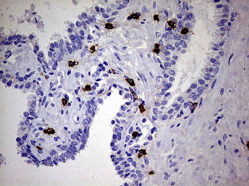 GBA / Glucosidase Beta Acid Antibody - Immunohistochemical staining of paraffin-embedded Human prostate tissue using anti-GBA mouse monoclonal antibody.  heat-induced epitope retrieval by 1 mM EDTA in 10mM Tris, pH8.0, 120C for 3min)