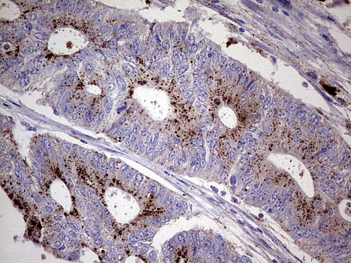 GBA / Glucosidase Beta Acid Antibody - Immunohistochemical staining of paraffin-embedded Human colon tissue using anti-GBA mouse monoclonal antibody.  heat-induced epitope retrieval by 1 mM EDTA in 10mM Tris, pH8.0, 120C for 3min)
