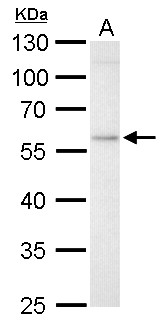 GBA / Glucosidase Beta Acid Antibody - GBA antibody detects GBA protein by Western blot analysis. A. 30 ug HepG2 whole cell lysate/extract. 10 % SDS-PAGE. GBA antibody dilution:1:1000