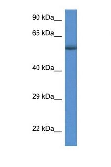 GBA / Glucosidase Beta Acid Antibody - GBA antibody Western blot of 435S Cell lysate. Antibody concentration 1 ug/ml.  This image was taken for the unconjugated form of this product. Other forms have not been tested.