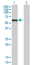 GBA / Glucosidase Beta Acid Antibody - Western blot of GBA expression in transfected 293T cell line by GBA monoclonal antibody (M01), clone 2E2.