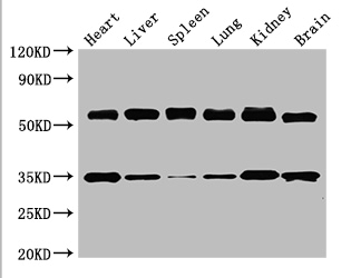GBA / Glucosidase Beta Acid Antibody - Positive WB detected in:Mouse heart tissue,Mouse liver tissue,Mouse spleen tissue,Mouse lung tissue,Mouse kidney tissue,Mouse brain tissue;All lanes:Gba antibody at 3.5ug/ml;Secondary;Goat polyclonal to rabbit IgG at 1/50000 dilution;Predicted band size: 58 kDa;Observed band size: 58,35 kDa;