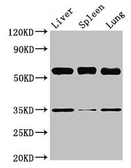 GBA / Glucosidase Beta Acid Antibody - Western Blot Positive WB detected in: Mouse liver tissue, Mouse spleen tissue, Mouse lung tissue All lanes: Gba antibody at 3.5µg/ml Secondary Goat polyclonal to rabbit IgG at 1/50000 dilution Predicted band size: 58 kDa Observed band size: 58 kDa