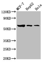 GBA / Glucosidase Beta Acid Antibody - Western Blot Positive WB detected in: MCF-7 whole cell lysate, HepG2 whole cell lysate, Hela whole cell lysate All Lanes: GBA antibody at 3.6µg/ml Secondary Goat polyclonal to rabbit IgG at 1/50000 dilution Predicted band size: 60, 58, 30, 51, 55 KDa Observed band size: 60 KDa