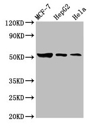 GBA / Glucosidase Beta Acid Antibody - Western Blot Positive WB detected in: MCF-7 whole cell lysate, HepG2 whole cell lysate, Hela whole cell lysate All lanes: GBA antibody at 3.6µg/ml Secondary Goat polyclonal to rabbit IgG at 1/50000 dilution Predicted band size: 60, 58, 30, 51, 55 kDa Observed band size: 51 kDa