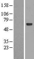 GBA / Glucosidase Beta Acid Protein - Western validation with an anti-DDK antibody * L: Control HEK293 lysate R: Over-expression lysate