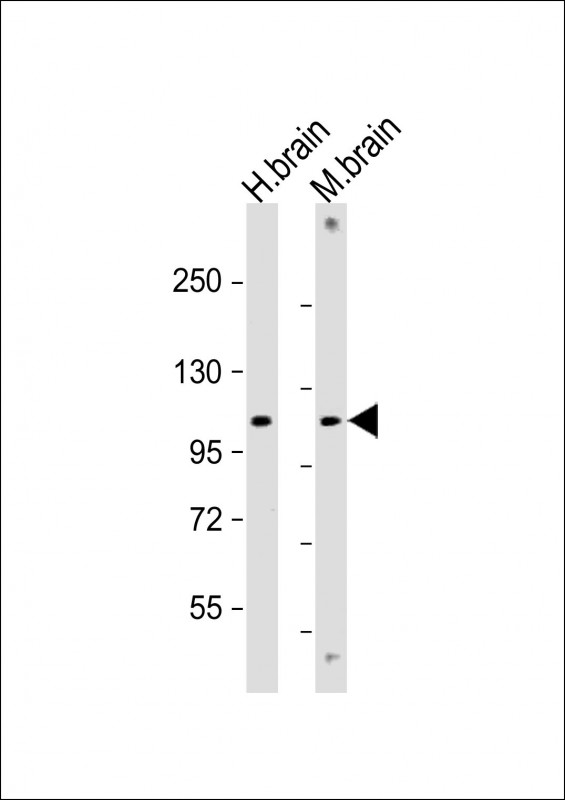 GBA2 Antibody - All lanes: Anti-GBA2 Antibody (Center) at 1:2000 dilution Lane 1: human brain lysate Lane 2: mouse brain lysate Lysates/proteins at 20 µg per lane. Secondary Goat Anti-Rabbit IgG, (H+L), Peroxidase conjugated at 1/10000 dilution. Predicted band size: 105 kDa Blocking/Dilution buffer: 5% NFDM/TBST.