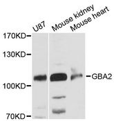 GBA2 Antibody - Western blot analysis of extracts of various cell lines, using GBA2 antibody at 1:3000 dilution. The secondary antibody used was an HRP Goat Anti-Rabbit IgG (H+L) at 1:10000 dilution. Lysates were loaded 25ug per lane and 3% nonfat dry milk in TBST was used for blocking. An ECL Kit was used for detection and the exposure time was 10s.