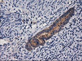 GBA3 / CBG Antibody - IHC of paraffin-embedded Human endometrium tissue using anti-GBA3 mouse monoclonal antibody.