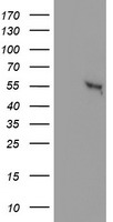 GBA3 / CBG Antibody - HEK293T cells were transfected with the pCMV6-ENTRY control (Left lane) or pCMV6-ENTRY GBA3 (Right lane) cDNA for 48 hrs and lysed. Equivalent amounts of cell lysates (5 ug per lane) were separated by SDS-PAGE and immunoblotted with anti-GBA3.