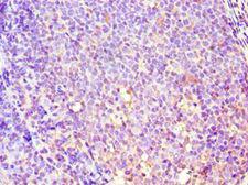 GBA3 / CBG Antibody - Immunohistochemistry of paraffin-embedded human tonsil using antibody at 1:100 dilution.