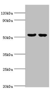 GBA3 / CBG Antibody - Western blot All lanes: GBA3 antibody at 10µg/ml Lane 1: Hela whole cell lysate Lane 2: HepG2 whole cell lysate Secondary Goat polyclonal to rabbit IgG at 1/10000 dilution Predicted band size: 54, 19 kDa Observed band size: 54 kDa
