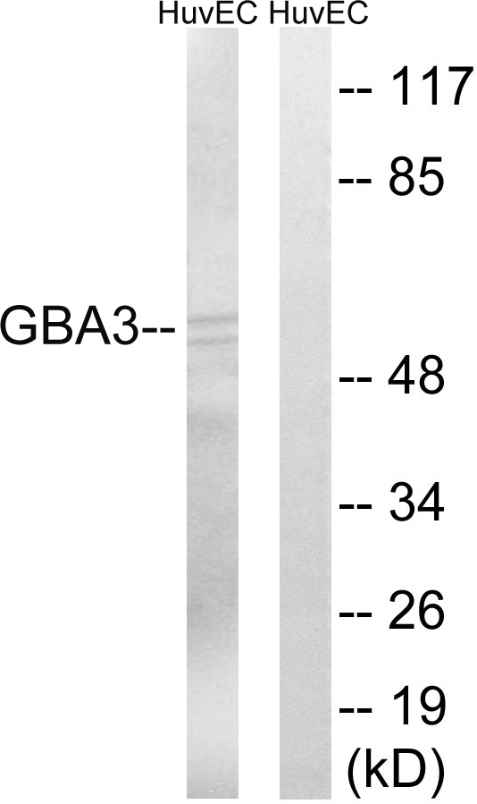 GBA3 / CBG Antibody - Western blot analysis of lysates from HUVEC cells, using GBA3 Antibody. The lane on the right is blocked with the synthesized peptide.