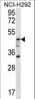 GBA3 / CBG Antibody - GBA3 Antibody western blot of NCI-H292 cell line lysates (35 ug/lane). The GBA3 antibody detected the GBA3 protein (arrow).