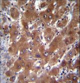 GBA3 / CBG Antibody - GBA3 Antibody immunohistochemistry of formalin-fixed and paraffin-embedded human liver tissue followed by peroxidase-conjugated secondary antibody and DAB staining.