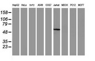 GBA3 / CBG Antibody - Western blot of extracts (35 ug) from 9 different cell lines by using anti-GBA3 monoclonal antibody.