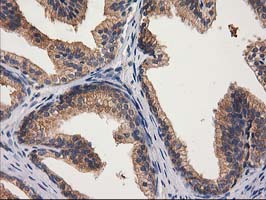 GBA3 / CBG Antibody - IHC of paraffin-embedded Human prostate tissue using anti-GBA3 mouse monoclonal antibody.