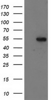GBA3 / CBG Antibody - HEK293T cells were transfected with the pCMV6-ENTRY control (Left lane) or pCMV6-ENTRY GBA3 (Right lane) cDNA for 48 hrs and lysed. Equivalent amounts of cell lysates (5 ug per lane) were separated by SDS-PAGE and immunoblotted with anti-GBA3.