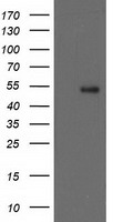 GBA3 / CBG Antibody - HEK293T cells were transfected with the pCMV6-ENTRY control (Left lane) or pCMV6-ENTRY GBA3 (Right lane) cDNA for 48 hrs and lysed. Equivalent amounts of cell lysates (5 ug per lane) were separated by SDS-PAGE and immunoblotted with anti-GBA3.