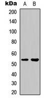 GBA3 / CBG Antibody - Western blot analysis of GBA3 expression in Jurkat (A); HeLa (B) whole cell lysates.