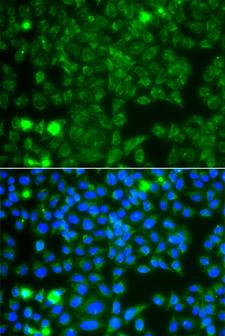 GBA3 / CBG Antibody - Immunofluorescence analysis of A549 cells.