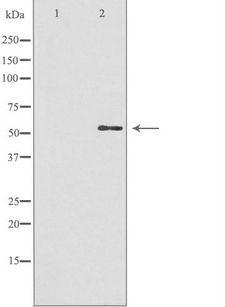 GBA3 / CBG Antibody - Western blot analysis of extracts of HuvEc cells using GBA3 antibody. The lane on the left is treated with the antigen-specific peptide.